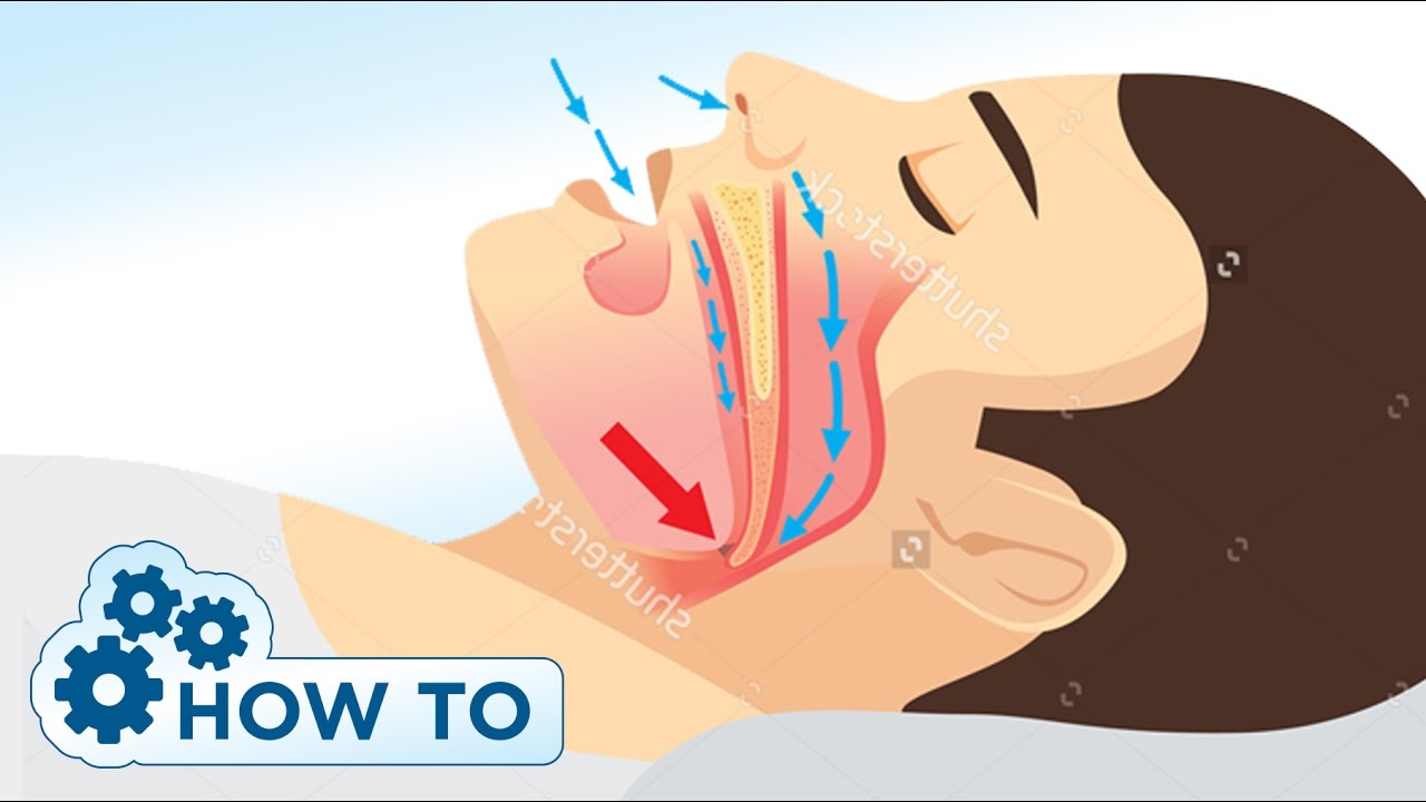 specialist for snoring problem